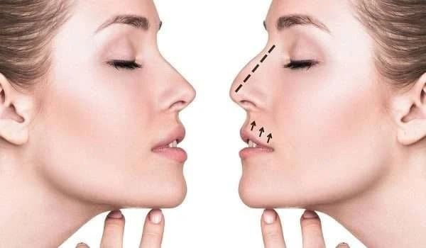 كيف يمكن اختيار طبيب مؤهل دون الاعتماد فقط على التكلفة