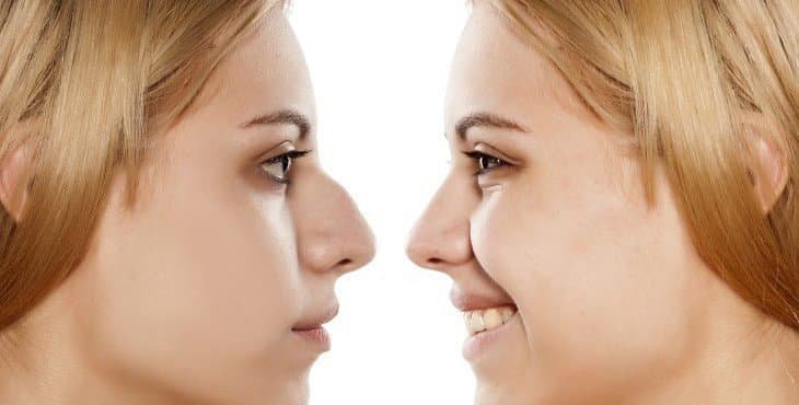 أكثر أنواع عمليات التجميل شيوعًا في الرياض