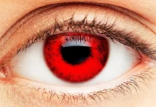 تفسير رؤية احمرار العين في المنام