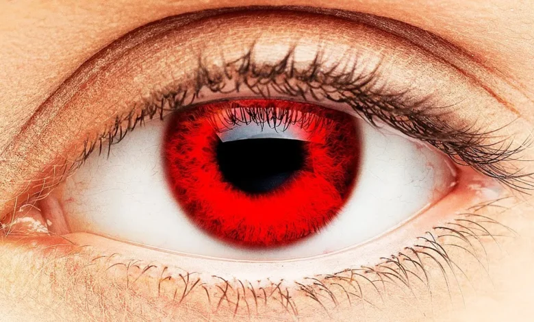 تفسير رؤية احمرار العين في المنام